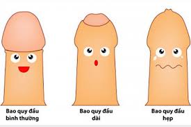 Bán hẹp da quy đầu - Hình ảnh minh họa